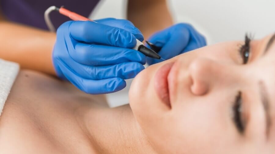 electrologist removing client's facial hair